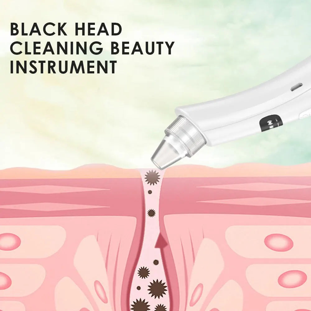 Face Cleansing Machine | Blackhead Remover with 3 Suction Modes for Dead Skin Removal