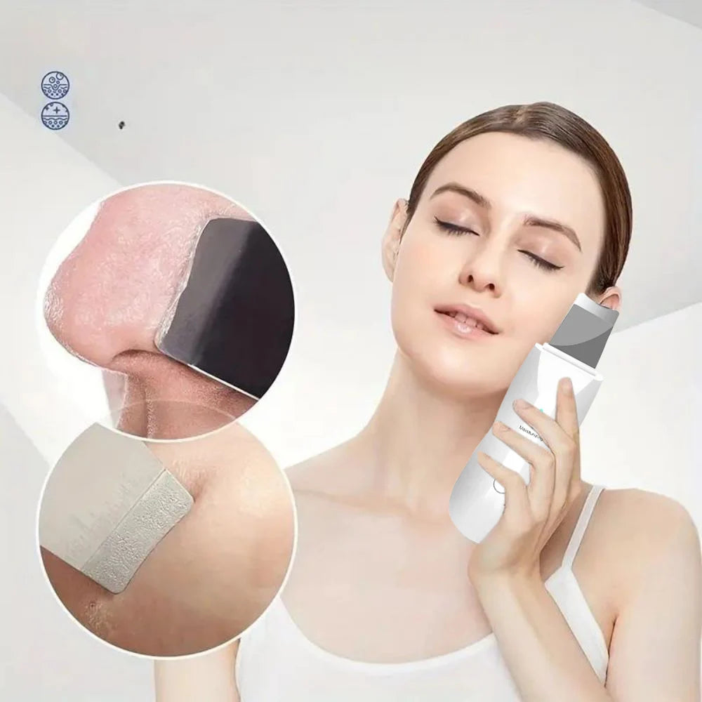 Ultrasonic Skin Scraper | Pore Cleaning & Deep Cleansing Device