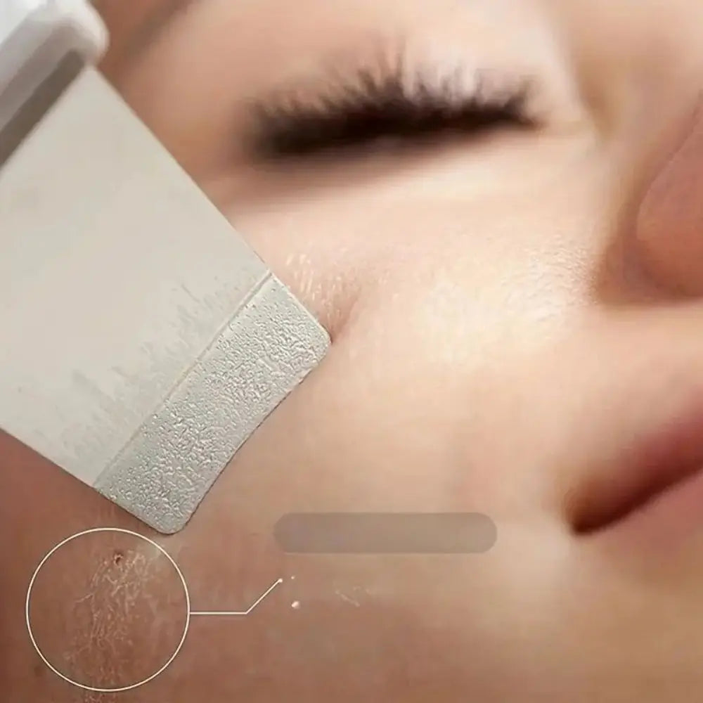 Ultrasonic Skin Scraper | Pore Cleaning & Deep Cleansing Device